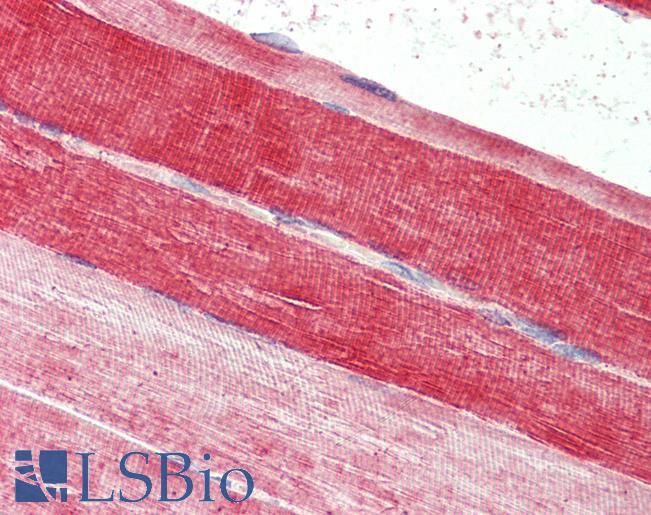 Goat Anti-B-FABP/ BLBP Antibody