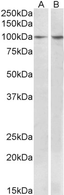 Goat Anti-BCAR1 Antibody