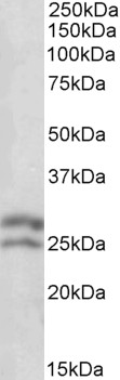 Goat Anti-BCL2 Antibody