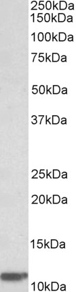 Goat Anti-beta-2-microglobulin (aa65-79) Antibody
