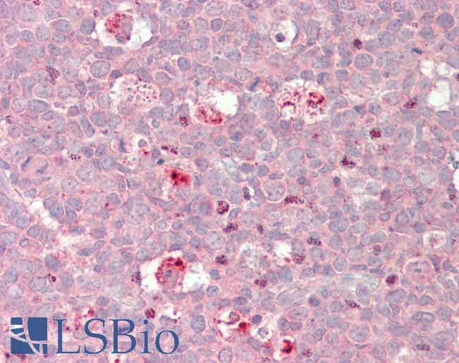 Goat Anti-BIRC3 (aa 109 -118) Antibody