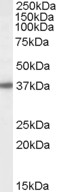 Goat Anti-Bisphosphate 3'-nucleotidase Antibody