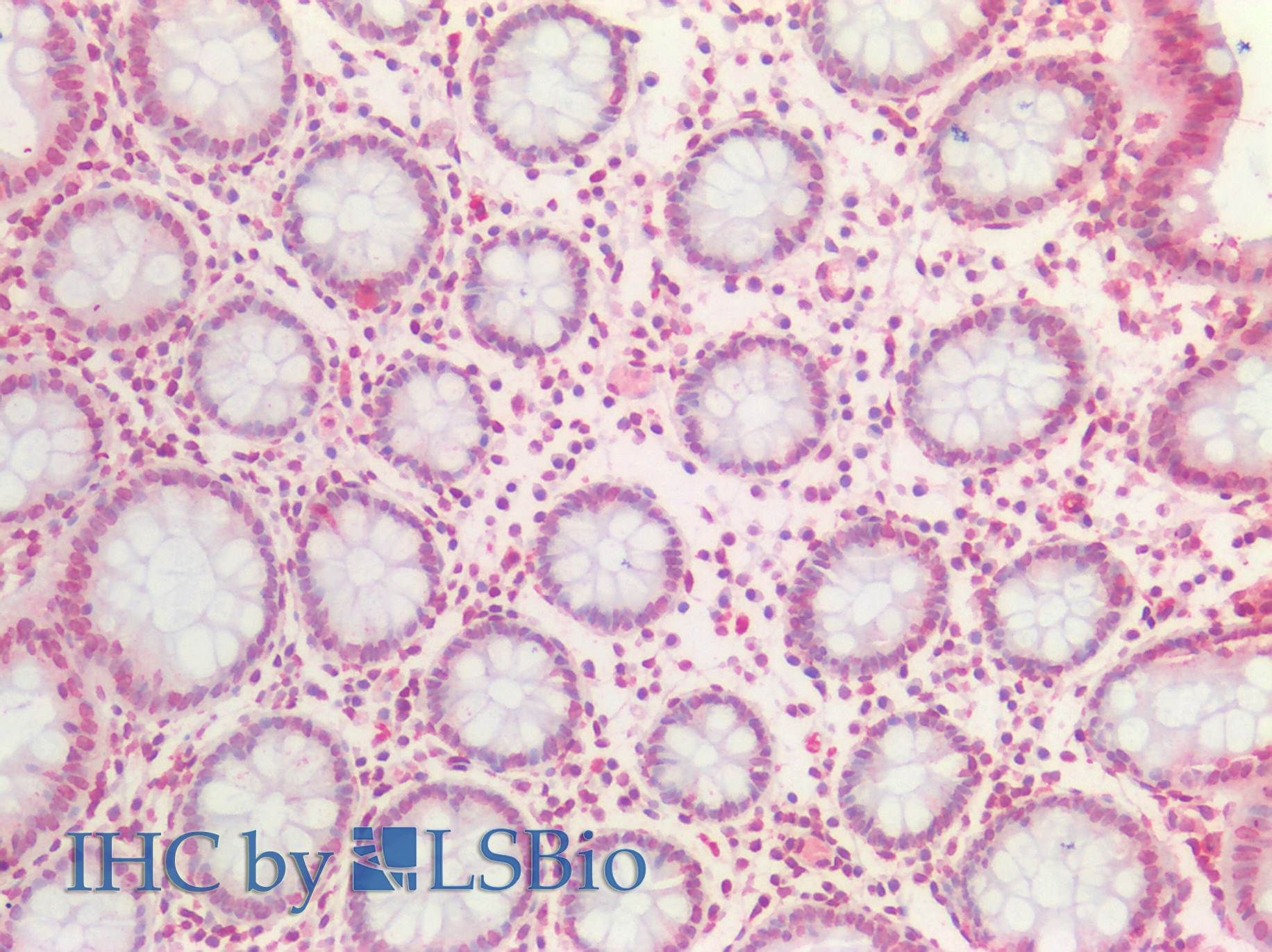Goat Anti-BMI1 Antibody