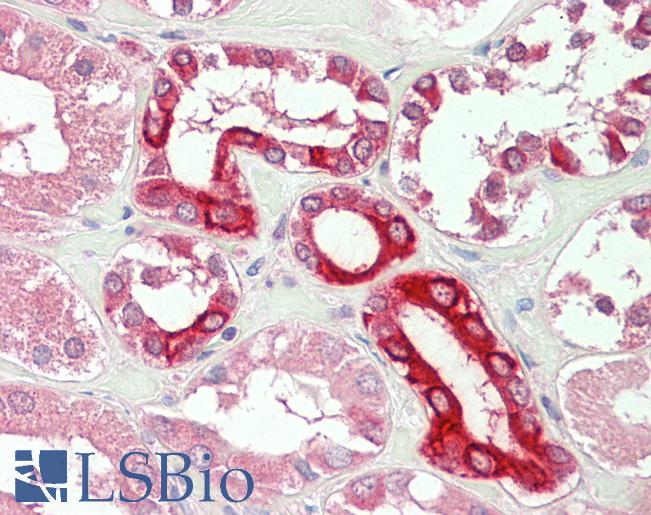 Goat Anti-BOK Antibody