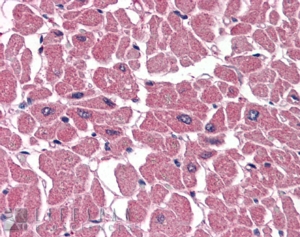 Goat Anti-BPOZ / ABTB1 Antibody