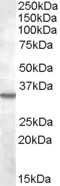 Goat Anti-Bradykinin receptor B1 Antibody