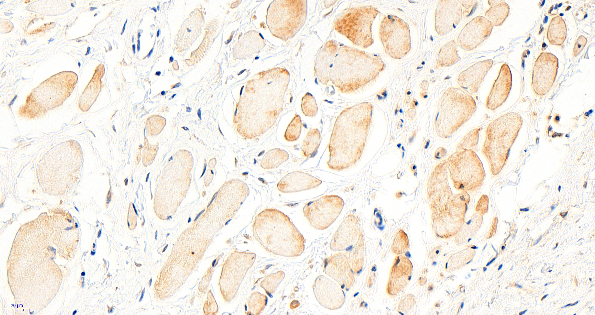 Goat Anti-BTRC / FWD1 Antibody