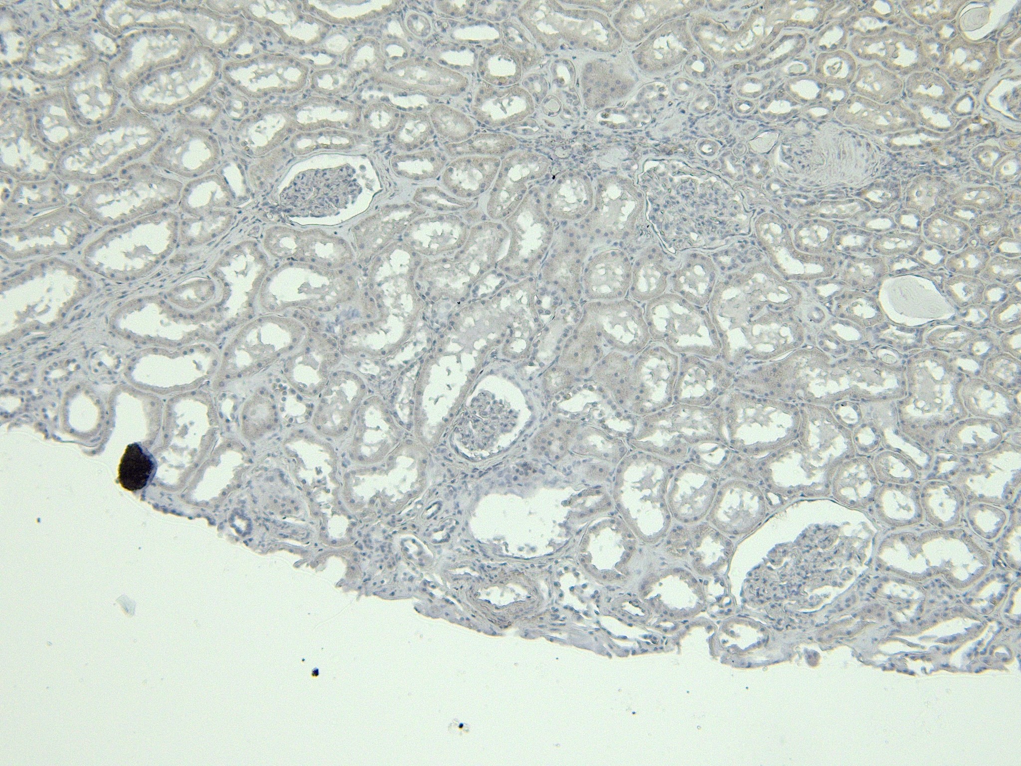 Goat Anti-calbindin D28 Antibody