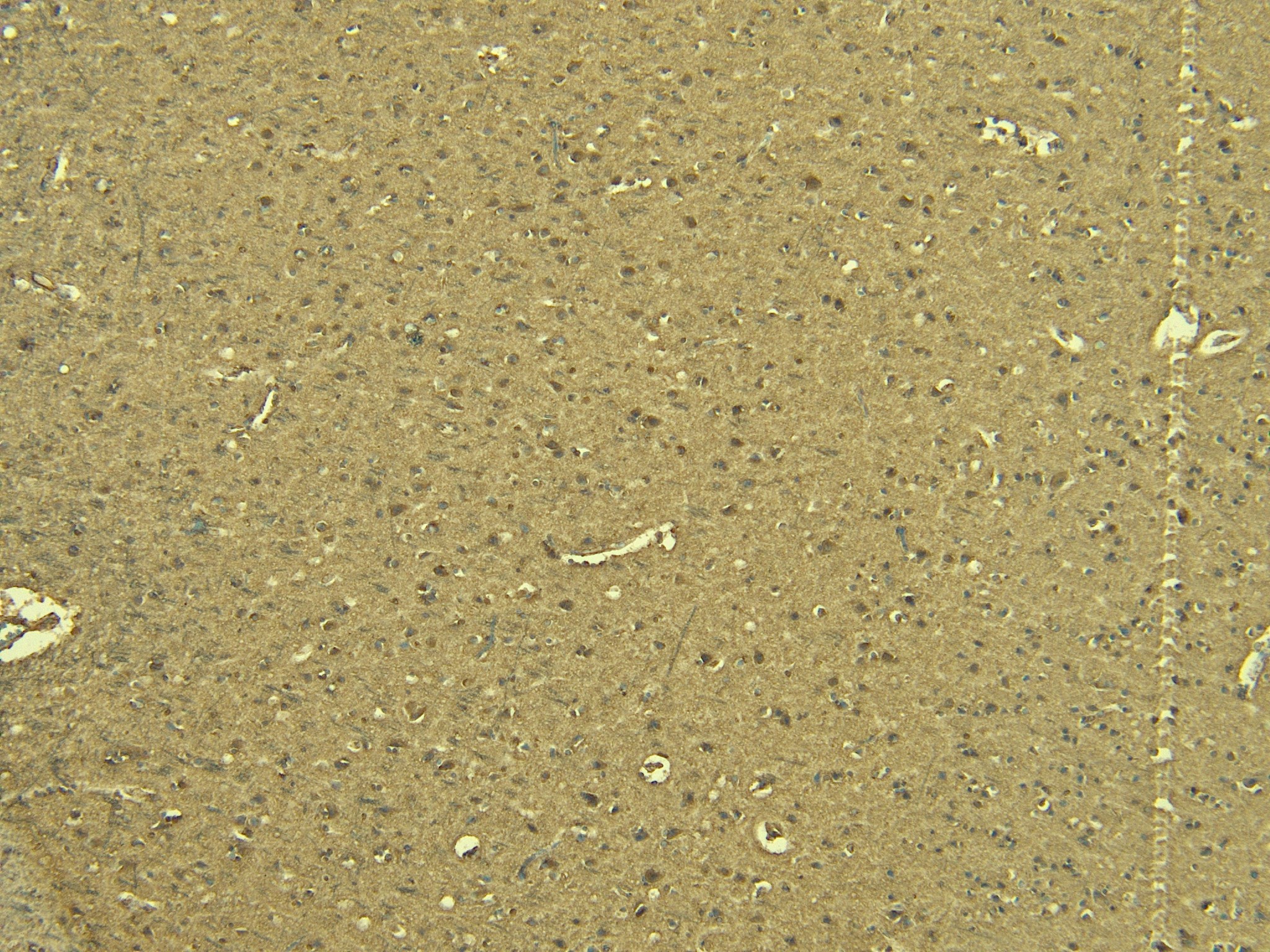 Goat Anti-Calnexin Antibody