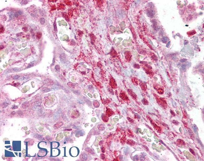 Goat Anti-Calponin 2 / CNN2 Antibody