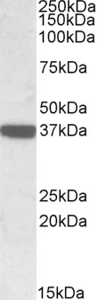 Goat Anti-Calponin 3 / CNN3 Antibody