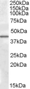 Goat Anti-CAMK1D Antibody