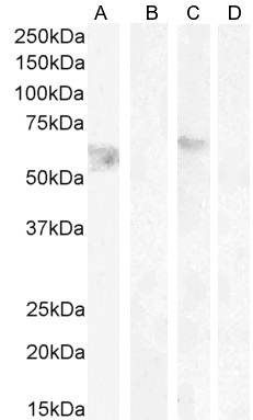 Goat Anti-Cannabinoid Receptor 1 Antibody