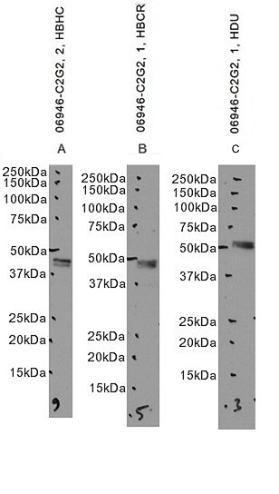 Goat Anti-Cannabinoid Receptor 2 Antibody