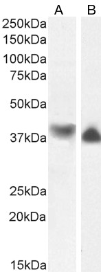 Goat Anti-CAPG Antibody