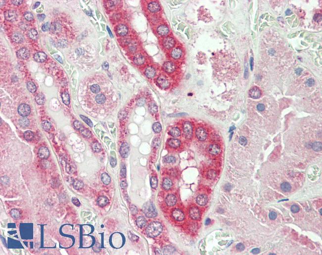 Goat Anti-CAPN1 Antibody