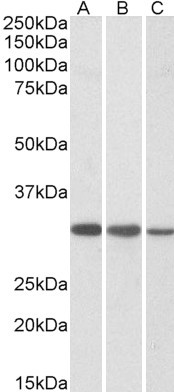 Goat Anti-CAPZB Antibody