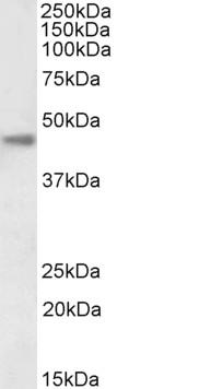 Goat Anti-carbonic anhydrase XII (aa188-199), Biotinylated Antibody