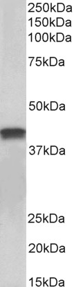 Goat Anti-cardiac troponin T (aa201-213) Antibody