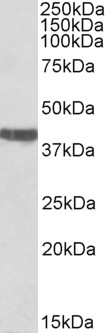 Goat Anti-cardiac troponin T Antibody