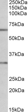 Goat Anti-Caspase 3 Antibody
