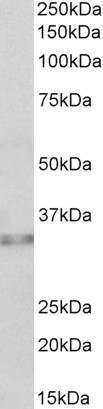 Goat Anti-Caspase 6 (alpha) Antibody