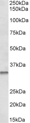 Goat Anti-Caspase 6 Antibody