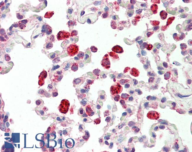 Goat Anti-cathepsin C / DPP1 (aa238-252) Antibody