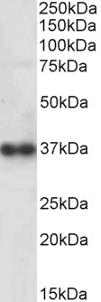Goat Anti-Cathepsin K Antibody