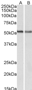 Goat Anti-CB1 (isoform a) Antibody