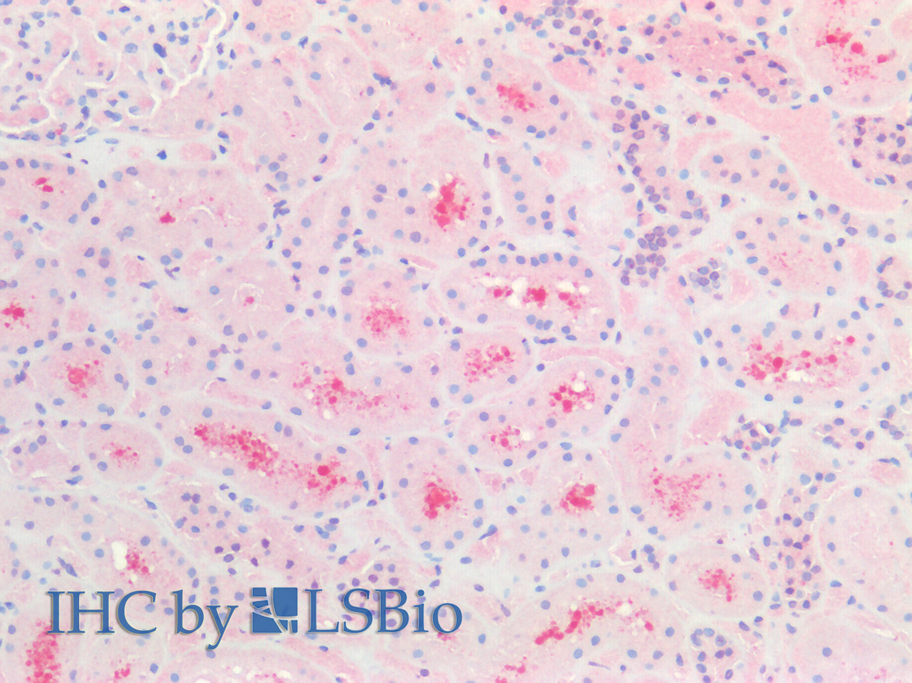 Goat Anti-CBR1 Antibody