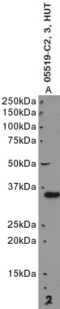 Goat Anti-CBR3 Antibody