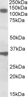 Goat Anti-CCAR1 Antibody