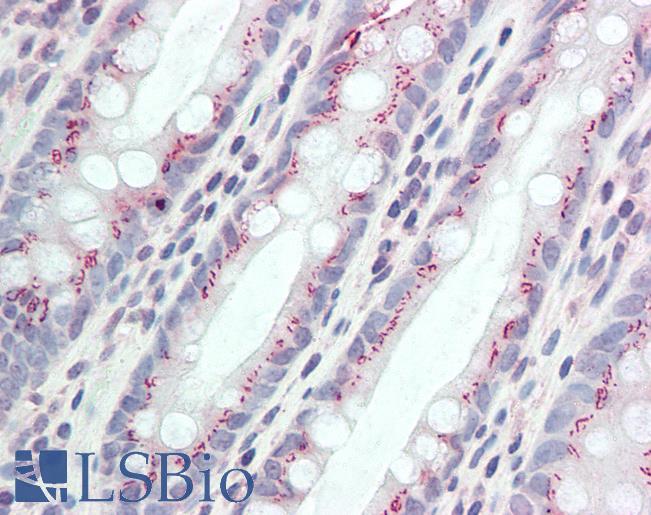 Goat Anti-CCDC3 (aa134-148) Antibody