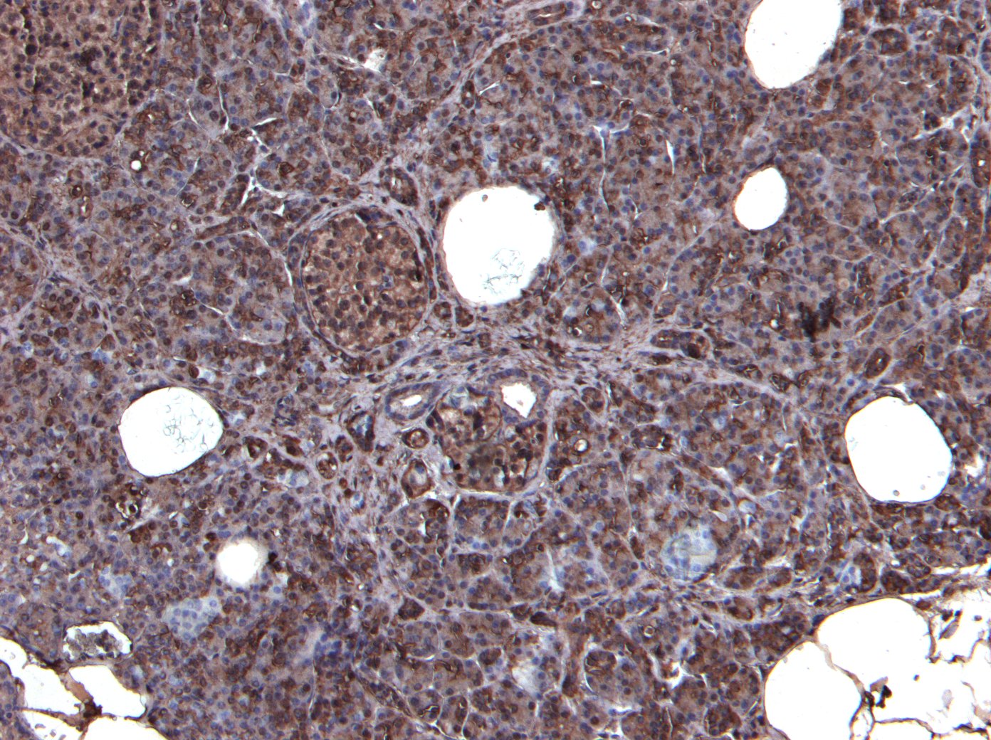 Goat Anti-CCKBR Antibody