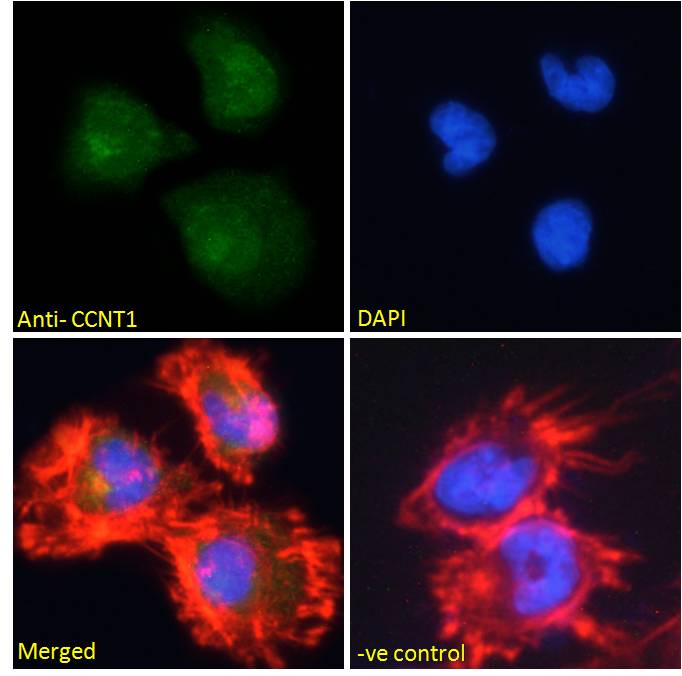 Goat Anti-CCNT1 Antibody
