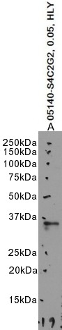 Goat Anti-CD20 / MS4A1 (C Terminus) Antibody