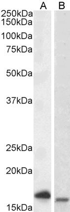 Goat Anti-CD3-ZETA / CD247 Antibody