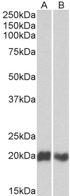 Goat Anti-CD3D (isoform A) Antibody