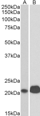 Goat Anti-CD3E (cytoplasmic) Antibody