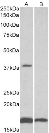 Goat Anti-CD57 / B3GAT1 Antibody