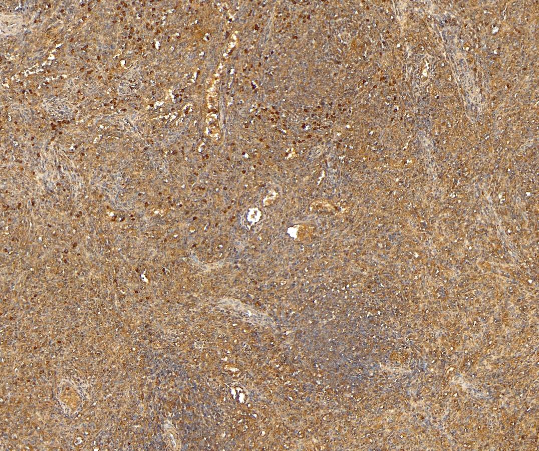 Goat Anti-CD68 Antibody