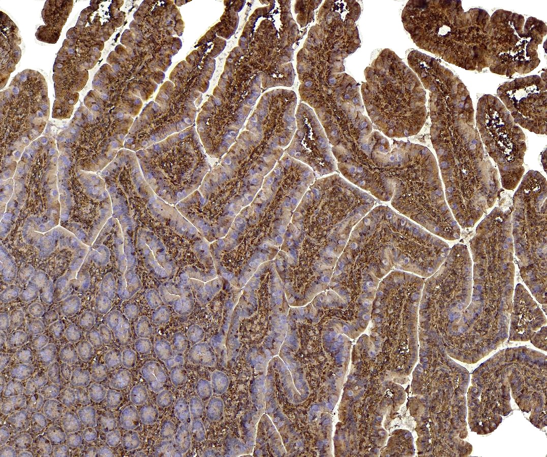 Goat Anti-CD74 Antibody