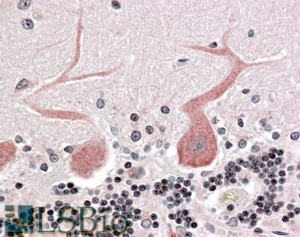 Goat Anti-Cdc42-binding kinase alpha Antibody