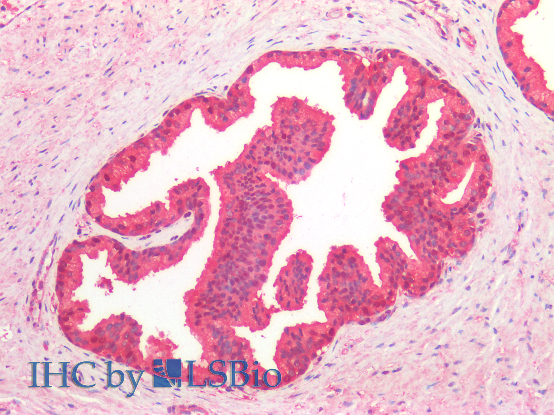 Goat Anti-CDC48/ VCP / YDL126C (baker's yeast, aa128-142) Antibody