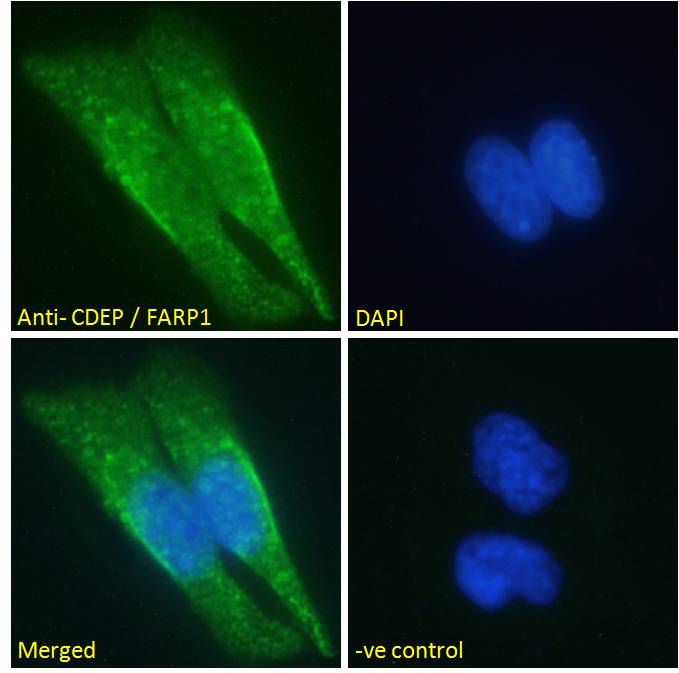 Goat Anti-CDEP / FARP1 Antibody