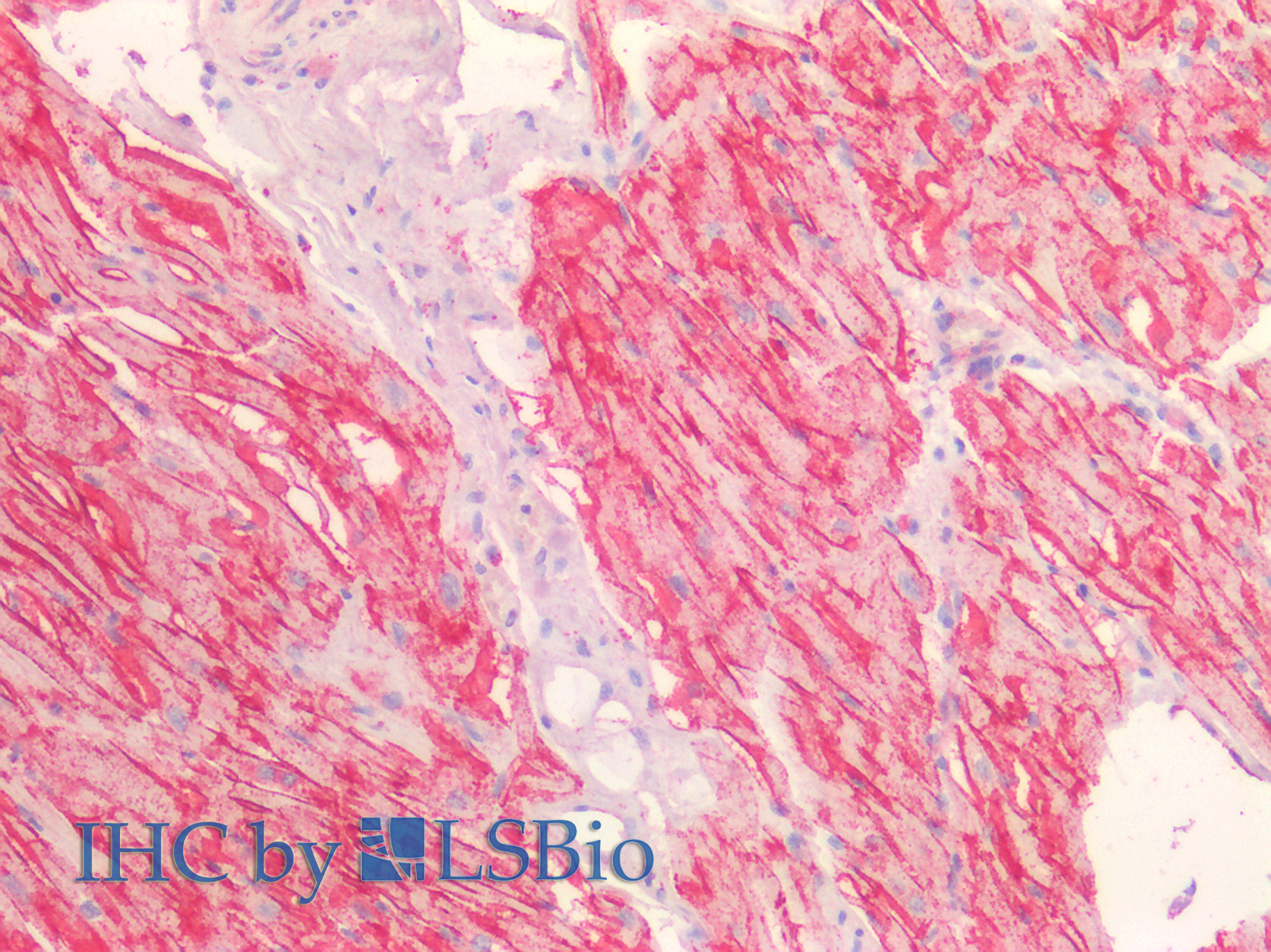 Goat Anti-CDH13 / H-cadherin Antibody