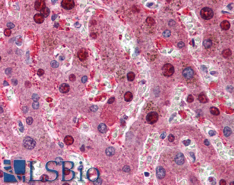 Goat Anti-CDKN2A (isoform 1) / p16INK4a Antibody