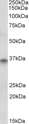 Goat Anti-CDX2 Antibody