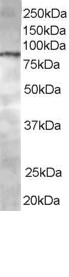 Goat Anti-CENTB1 / ACAP1 Antibody
